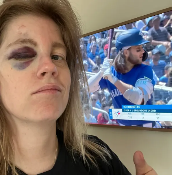 Fan hit by foul ball #bluejays #mlb