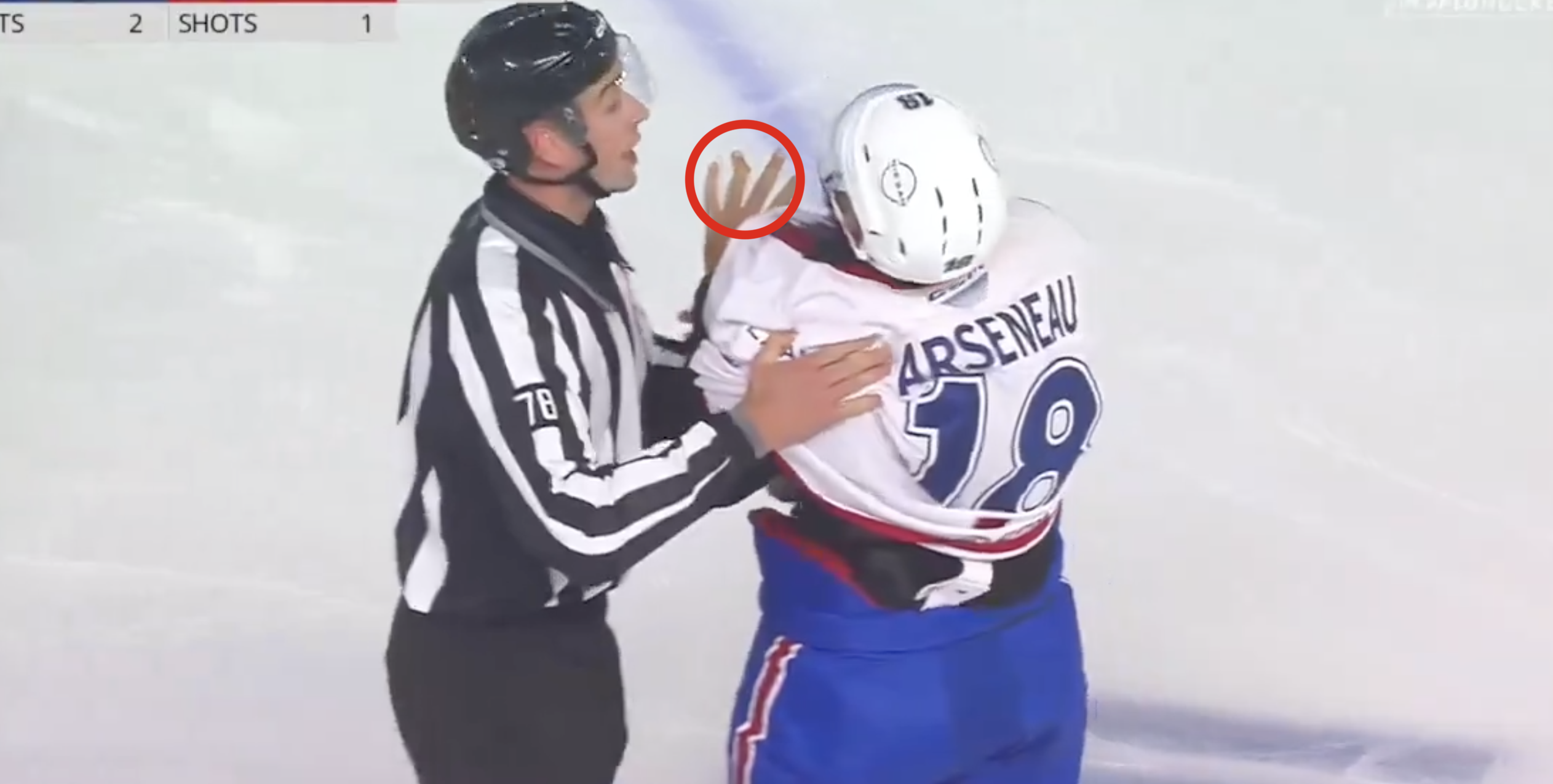 Graphic scene as Vincent Arseneau breaks multiple fingers and snaps